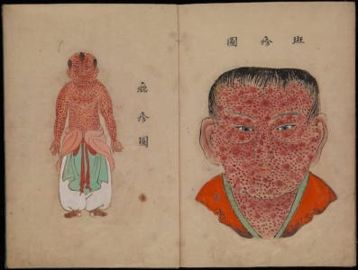 Illustration from 'Toshin seiyo' ('The essentials of smallpox') 